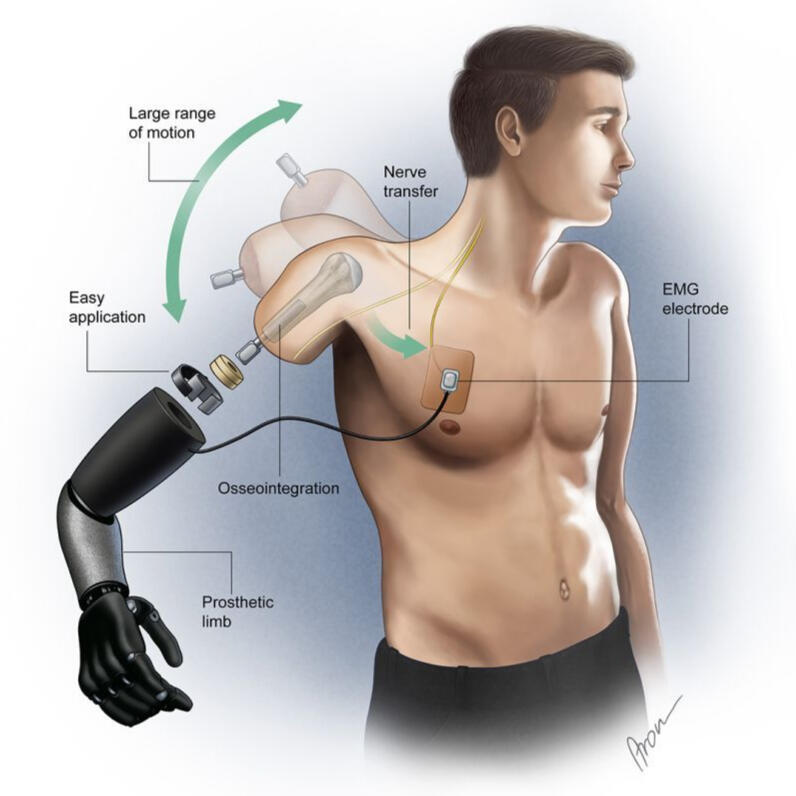 Advanced product design using AI, Solidworks, and 3D prototyping for humanoid robotics and medical technologies